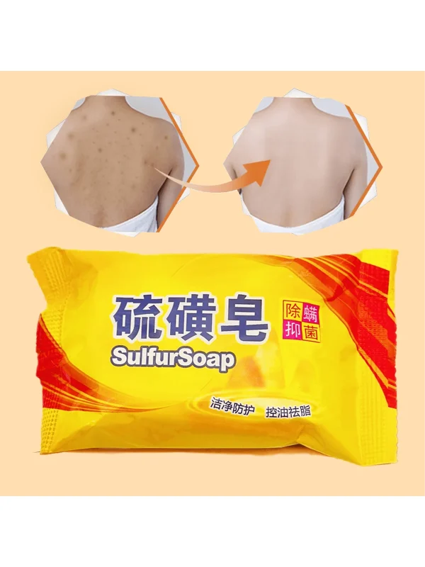 SHEIN 2pcs Yellow Sulfur Soap For Bathing & Hand Washing